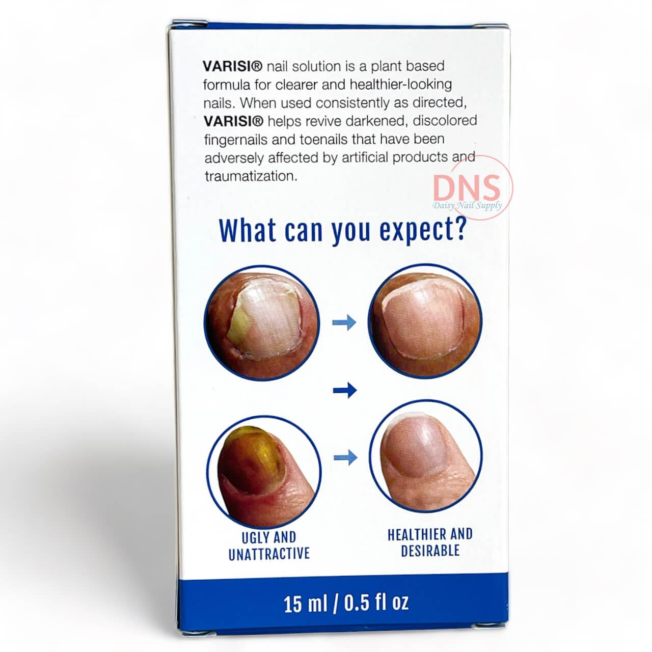 Varisi Varisi Nail Solution For Nail Fungus Treatment 0.5 fl oz (Pack of 6 ...